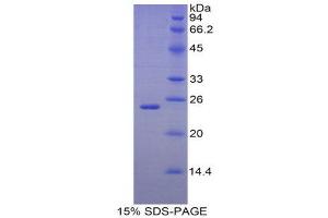 SDS-PAGE (SDS) image for Noggin (NOG) protein (His tag) (ABIN1080386) (NOG Protein (His tag))