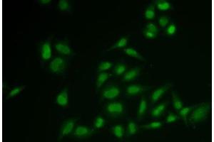 Immunofluorescence analysis of U2OS cells using SSRP1 Polyclonal Antibody (SSRP1 antibody)