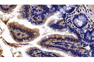 Immunohistochemistry (IHC) image for anti-Mitogen-Activated Protein Kinase Kinase 6 (MAP2K6) (AA 46-306) antibody (ABIN7443209)