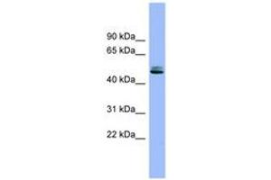 Image no. 1 for anti-serine Peptidase Inhibitor, Kunitz Type 1 (SPINT1) (AA 395-444) antibody (ABIN6743332)