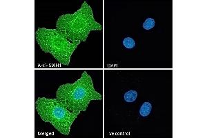 (ABIN184675) Immunofluorescence analysis of paraformaldehyde fixed U2OS cells, permeabilized with 0. (SIAH1 antibody  (N-Term))