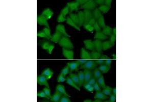 Immunofluorescence analysis of MCF7 cells using HBA1 Polyclonal Antibody (HBA1 antibody)