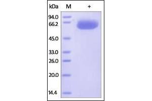 Human PD-L1, Fc Tag on SDS-PAGE under reducing (R) condition. (PD-L1 Protein (AA 19-238) (Fc Tag))