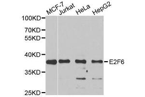 Western blot analysis of extracts of various cell lines, using E2F6 antibody.