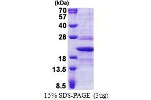 SDS-PAGE (SDS) image for Transmembrane Emp24-Like Trafficking Protein 10 (TMED10) (AA 32-185) protein (His tag) (ABIN6387259) (TMED10 Protein (AA 32-185) (His tag))