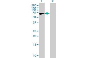 Western Blotting (WB) image for anti-Calcium Channel, Voltage-Dependent, beta 3 Subunit (CACNB3) (AA 1-484) antibody (ABIN513939)