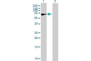 Western Blot analysis of CACNB3 expression in transfected 293T cell line by CACNB3 MaxPab polyclonal antibody.