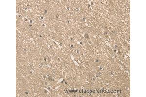 Immunohistochemistry of Human brain  using ALDH8A1 Polyclonal Antibody at dilution of 1:40 (ALDH8A1 antibody)