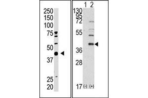 Image no. 2 for anti-SUMO1 Activating Enzyme Subunit 1 (SAE1) (C-Term) antibody (ABIN357744) (SAE1 antibody  (C-Term))