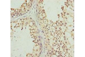 Immunohistochemistry of paraffin-embedded human testis tissue using ABIN7163477 at dilution of 1:100 (PIWIL1 antibody  (AA 390-690))