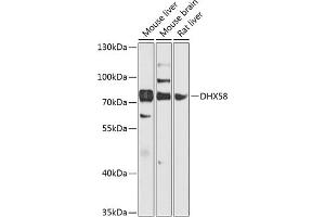 Western blot analysis of extracts of various cell lines, using DHX58 antibody (ABIN6129372, ABIN6139609, ABIN6139610 and ABIN6224272) at 1:1000 dilution.