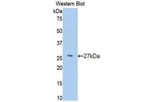 Western blot analysis of recombinant Human IFNa/bR1. (IFNAR1 antibody  (AA 28-227))