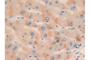 Detection of CCND2 in Human Liver Tissue using Polyclonal Antibody to Cyclin D2 (CCND2) (Cyclin D2 antibody  (AA 68-278))