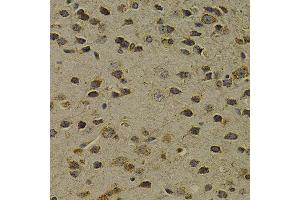 Immunohistochemistry (IHC) image for anti-8-Oxoguanine DNA Glycosylase (OGG1) (AA 1-345) antibody (ABIN3021937) (OGG1 antibody  (AA 1-345))