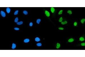 IF analysis of POLA1 using anti-POLA1 antibody (ABIN7601759).