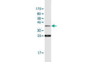 Western Blot detection against Immunogen (36. (SSH1 antibody  (AA 950-1049))