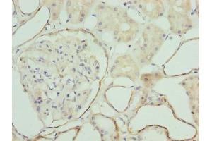 Immunohistochemistry of paraffin-embedded human kidney tissue using ABIN7176389 at dilution of 1:100 (ZNF563 antibody  (AA 214-476))