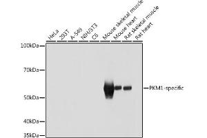 Western blot analysis of extracts of various cell lines, using PKM1-specific antibody (ABIN7269383) at 1:1000 dilution. (PKM1-Specific antibody)