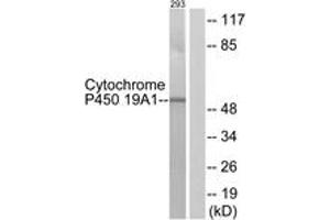 Western blot analysis of extracts from 293 cells, using Cytochrome P450 19A1 Antibody. (Aromatase antibody  (AA 221-270))