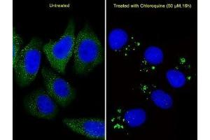 Fluorescent image of U251 cells stained with anti-ATG5 antibody diluted at 1:25 dilution. (ATG5 antibody  (AA 209-238))