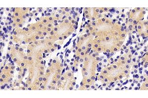 Detection of IFNa in Mouse Kidney Tissue using Polyclonal Antibody to Interferon Alpha (IFNa) (IFNA antibody  (AA 24-189))