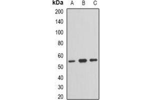 Western blot analysis of TFG expression in Hela (A), HepG2 (B), mouse brain (C) whole cell lysates. (TFG antibody)