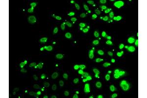 Immunofluorescence analysis of A549 cells using FIP1L1 antibody. (FIP1L1 antibody)