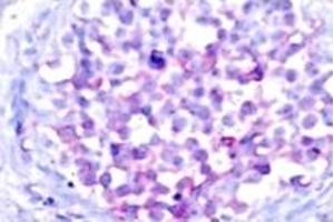 Image no. 2 for anti-V-Raf-1 Murine Leukemia Viral Oncogene Homolog 1 (RAF1) (pSer259) antibody (ABIN318109) (RAF1 antibody  (pSer259))