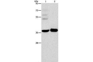 Western Blot analysis of A172 cell and Human fetal brain tissue using SERPINE2 Polyclonal Antibody at dilution of 1:450 (SERPINE2 antibody)