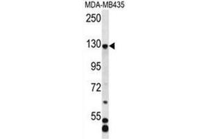 C7orf63 Antibody (N-term) western blot analysis in MDA-MB435 cell line lysates (35µg/lane). (C7orf63 antibody  (N-Term))