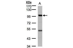WB Image Sample(30 ug whole cell lysate) A:Hep G2 , 7. (KAT2B antibody  (C-Term))