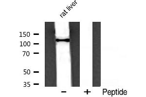 Western blot analysis of PI3 kinase P110α expression in rat liver (PIK3CA antibody  (Internal Region))