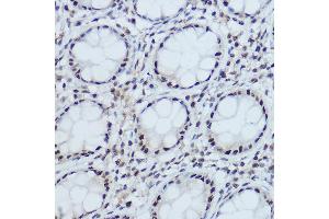 Immunohistochemistry (IHC) image for anti-Damage Specific DNA Binding Protein 1 (DDB1) (C-Term) antibody (ABIN1679509)
