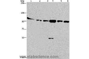 Western blot analysis of Human testis tissue, K562, A549, Raji, NIH/3T3 and Hela cell, using PRKD3 Polyclonal Antibody at dilution of 1:200 (PRKD3 antibody)