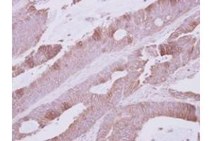 Image no. 1 for anti-Na Pump alpha Subunit (ATPALPHA) (Internal Region) antibody (ABIN1493677) (Atpalpha antibody  (Internal Region))