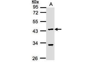 WB Image Sample(30 ug whole cell lysate) A:MOLT4 , 10% SDS PAGE antibody diluted at 1:1000 (KLF15 antibody  (N-Term))