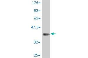 Western Blot detection against Immunogen (37 KDa) . (MTOR antibody  (AA 1521-1620))