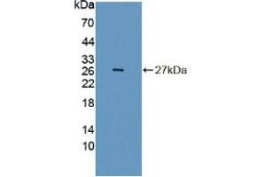Western blot analysis of recombinant Mouse INSM1. (INSM1 antibody  (AA 278-518))