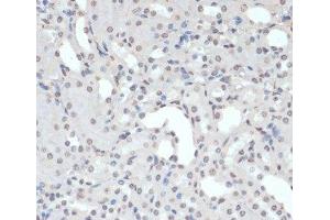 Immunohistochemistry of paraffin-embedded Mouse kidney using Phospho-Jak2(Y1007/1008) Polyclonal Antibody at dilution of 1:200 (40x lens). (JAK2 antibody  (pTyr1007, pTyr1008))