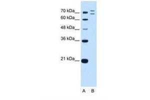 Image no. 2 for anti-Ring Finger Protein 168 (RNF168) (AA 401-450) antibody (ABIN6739167) (RNF168 antibody  (AA 401-450))