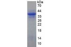 SDS-PAGE analysis of Human Keratin 10 Protein.