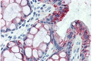 Human Colon (formalin-fixed, paraffin-embedded) stained with CLDN4 antibody ABIN334265 at 5 ug/ml followed by biotinylated anti-mouse IgG secondary antibody ABIN481714, alkaline phosphatase-streptavidin and chromogen. (Claudin 4 antibody  (C-Term))