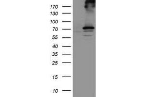 HEK293T cells were transfected with the pCMV6-ENTRY control (Left lane) or pCMV6-ENTRY RPN1 (Right lane) cDNA for 48 hrs and lysed. (RPN1 antibody)