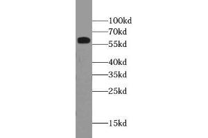 WB analysis of HEK293T cells subjected to SDS-PAGE, using RBM39 antibody (1/500 dilution).