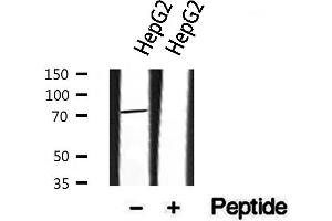 Western blot analysis of extracts from HepG2, using HRP2 antibody.