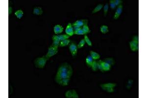 Immunofluorescent analysis of HepG2 cells using ABIN7167586 at dilution of 1:100 and Alexa Fluor 488-congugated AffiniPure Goat Anti-Rabbit IgG(H+L) (RGS1 antibody  (AA 14-209))