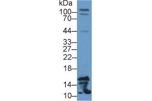 Detection of FABP4 in Rat Testis lysate using Polyclonal Antibody to Fatty Acid Binding Protein 4 (FABP4) (FABP4 antibody  (AA 2-132))
