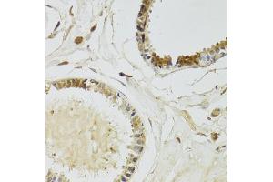 Immunohistochemistry of paraffin-embedded human breast using KLK10 Antibody (ABIN6142943) at dilution of 1:100 (40x lens). (Kallikrein 10 antibody  (AA 35-276))