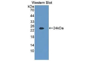 Detection of Recombinant PCK2, Human using Polyclonal Antibody to Phosphoenolpyruvate Carboxykinase 2, Mitochondrial (PCK2) (PEPCK antibody  (AA 33-198))