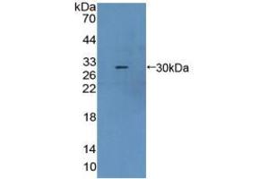 Western blot analysis of recombinant Mouse CBR1. (CBR1 antibody  (AA 66-271))